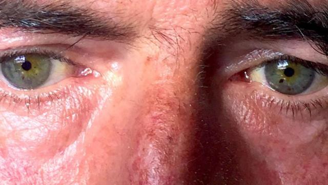 Francisco Galiano, Paquillo para los amigos, se contagió de la hepatitis en la cárcel.