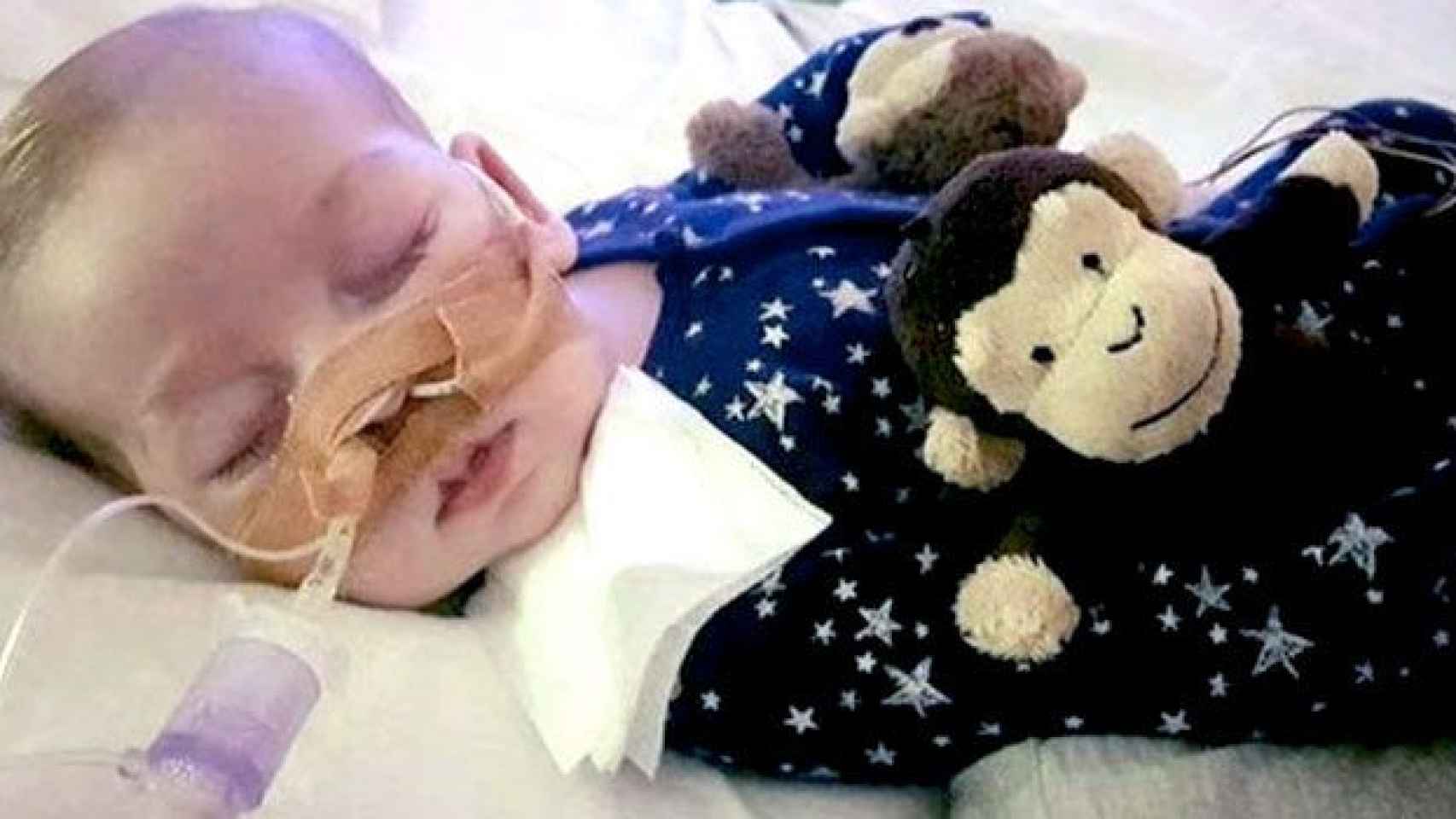 El pequeño Charlie Gard, de tan sólo 11 meses de vida / CG