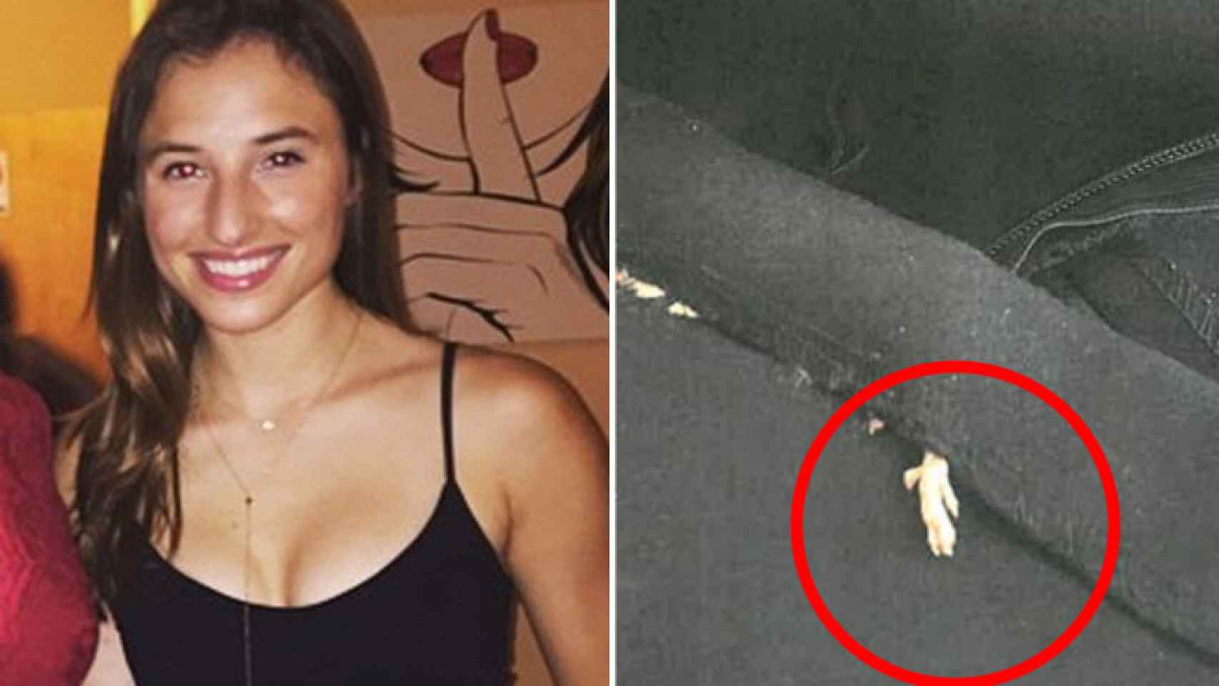 La joven Cailey Fiesel y la pata de la rata que encontró cosida a su vestido de Zara / FACEBOOK