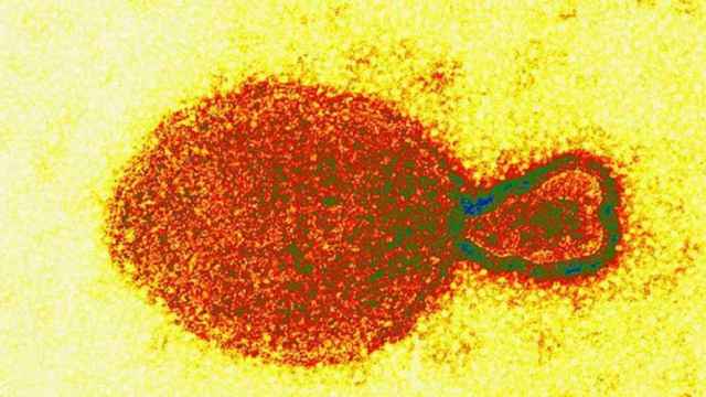Imagen microscópica de un henipavirus / WIKIPEDIA