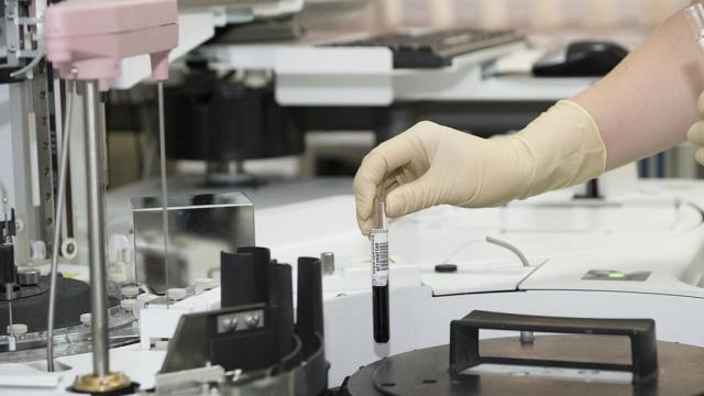 Imagen de un laboratorio clínico como el del Hospital Universitario Arnau de Vilanova / PIXABAY