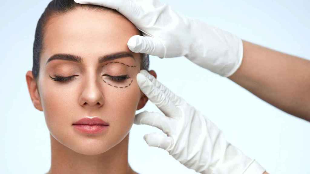 Marcas para realizar una blefaroplastia, la operación estética de párpados