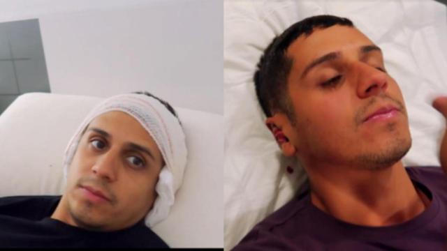 Cristofer, de 'La isla de las tentaciones' se opera las orejas de soplillo / MTMAD