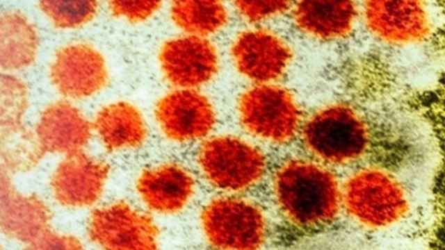 El virus de la hepatitis / EP