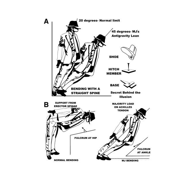 Sistema utilizado por Michael Jackson para sus zapatos en 'Smooth criminal' / JOURNAL OF NEUROSURGERY