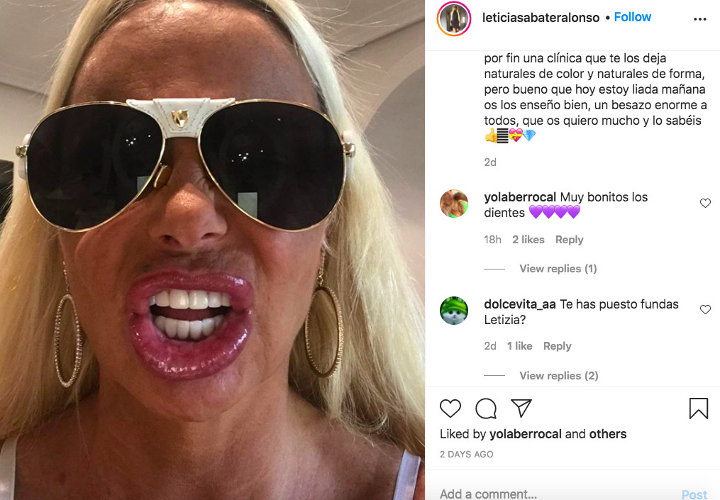Leticia Sabater presume de nueva dentadura en las redes sociales / INSTAGRAM