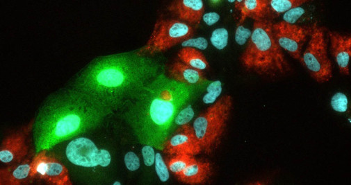 Replicación del virus de la hepatitis C (VHC) y del virus de la hepatitis E (VHE) en células hepáticas humanas - ABTEILUNG FÜR MOLEKULARE UND MEDIZINISCHE VIROLOGI / EUROPA PRESS