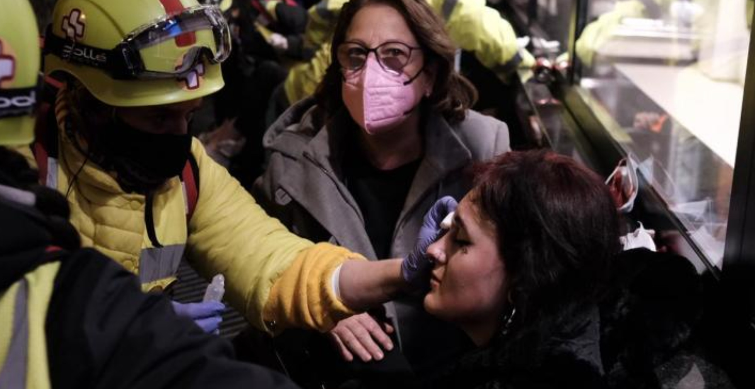 La joven herido en un ojo, por el supuesto disparo de una bala de 'foam' durante los disturbios / PABLO MIRANZO (CG)