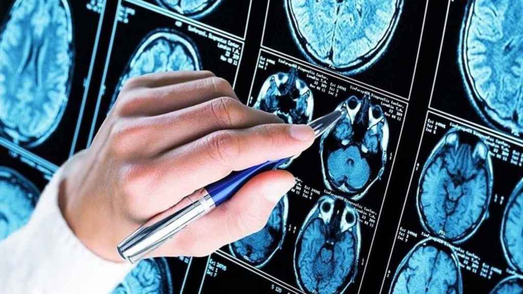 Pruebas médicas de la afectación cerebral del Alzheimer / EP