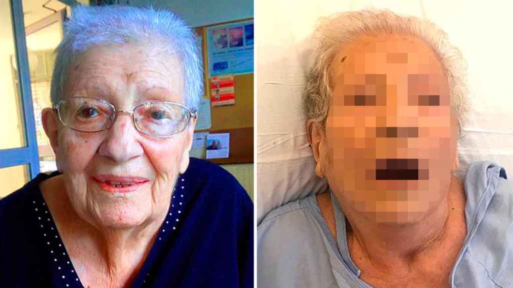 Carmen C., cuyo estado de salud se deterioró mientras estaba en la residencia Trinitat Nova / CG