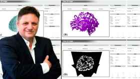 Consejero delegado de Fractalmed, una de las 10 empresas que huyen hoy de Cataluña