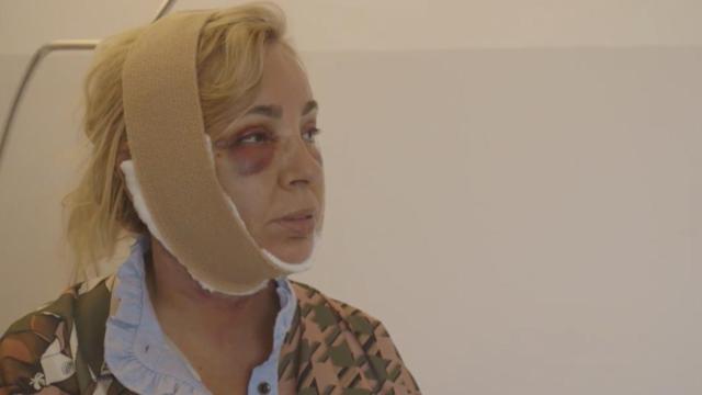 La cara de Carmen Borrego ha cambiado mucho gracias a las operaciones estéticas / MEDIASET