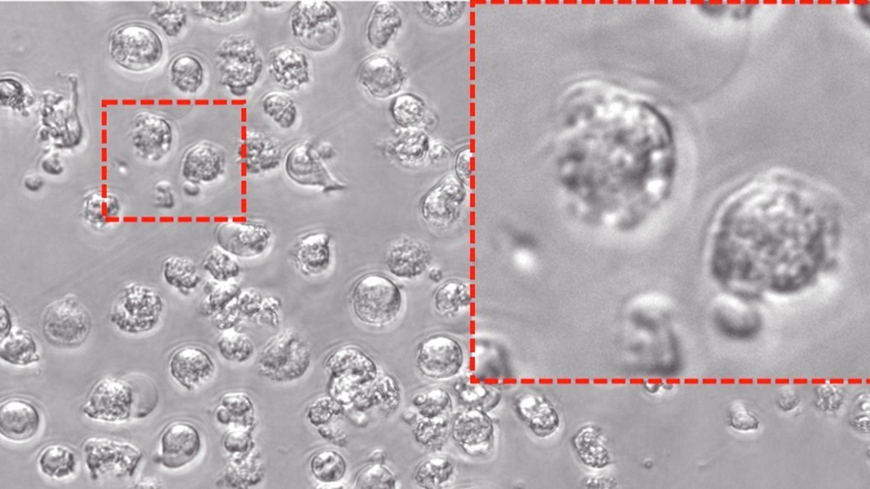 Un estudio identifica una diana para el tratamiento de la leucemia con fármacos experimentales / EUROPA PRESS