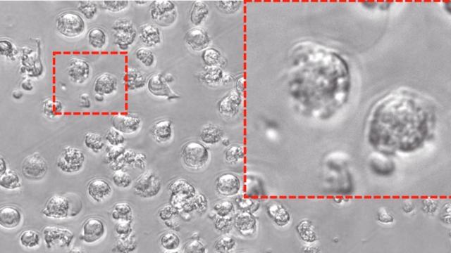 Un estudio identifica una diana para el tratamiento de la leucemia con fármacos experimentales / EUROPA PRESS