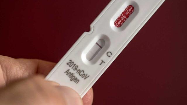 Un test de antígenos con resultado negativo / EFE