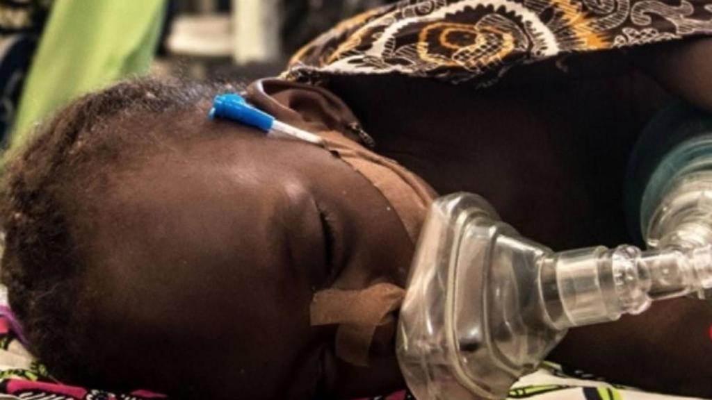 Niño que padece neumonía infantil / EUROPA PRESS