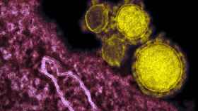 La variante brasileña del coronavirus SARS-CoV-2 se expande / EP