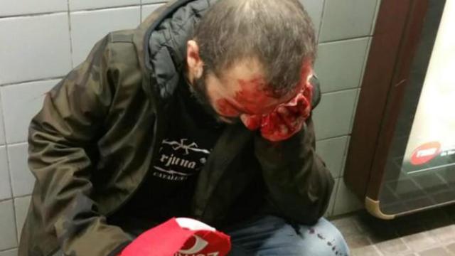 Brutal agresión a un participante en la manifestación de Jusapol en Barcelona: El hombre agredido en el metro de Barcelona tras participar en la manifestación de Jusapol / TWITTER