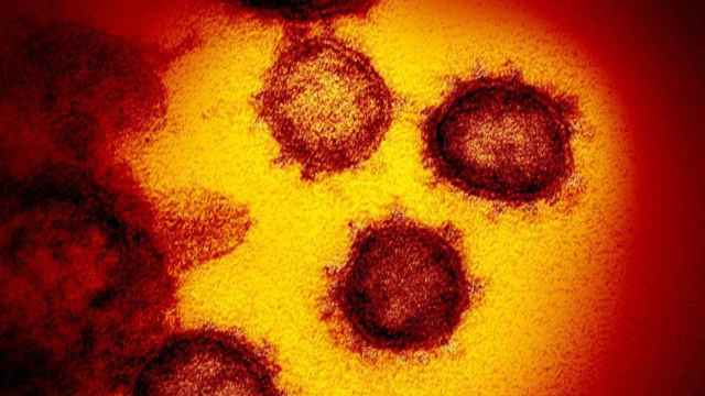 Imagen microscópica del coronavirus SARS-CoV-2 que causa el Covid