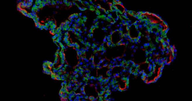 Imagen fluorescente de la infección del coronavirus SARS-CoV-2 en minipulmones / UNIVERSIDAD DE DUKE