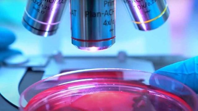 Imagen de un microscopio para investigar el cáncer