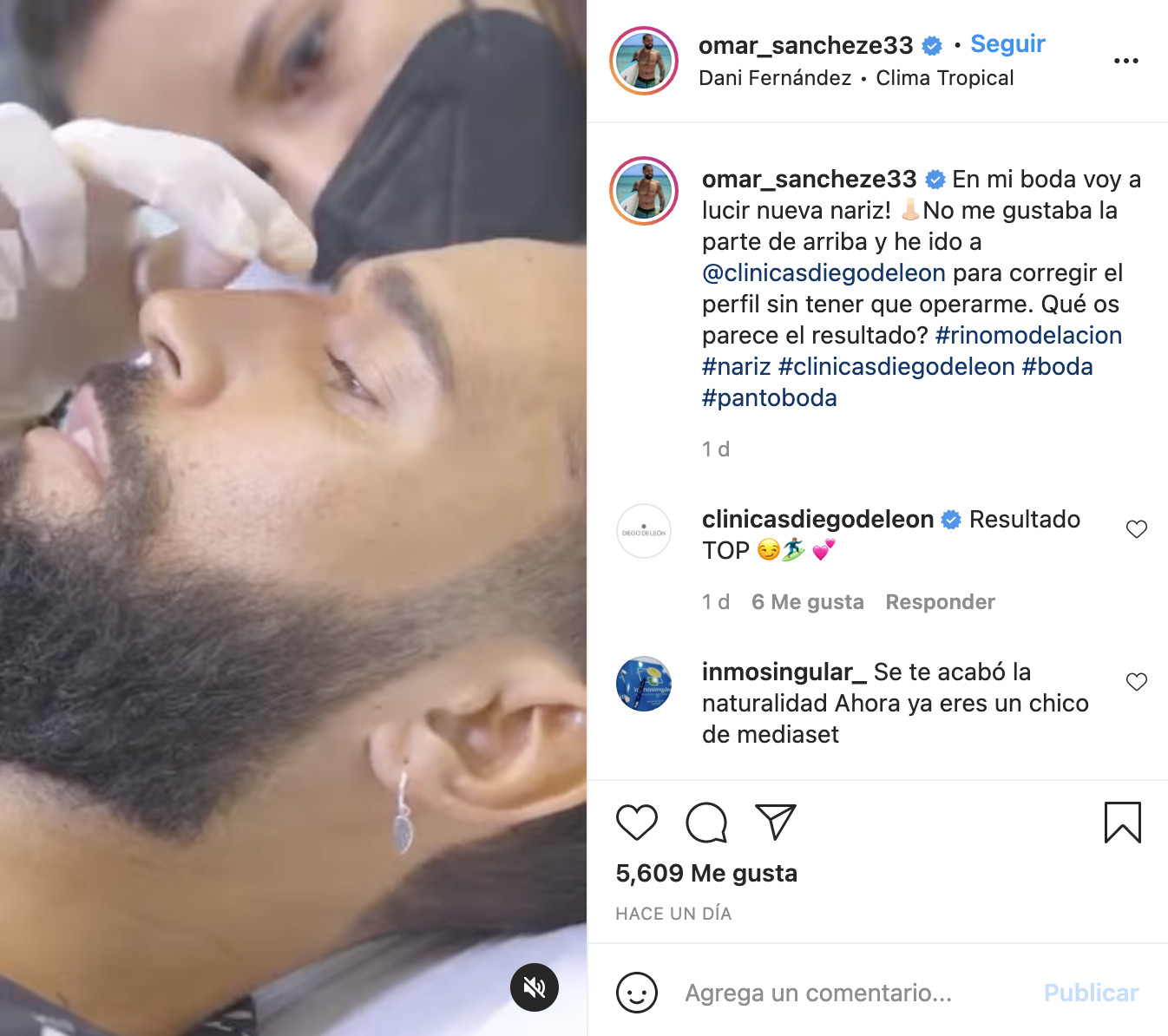 El retoque de Omar Sánchez / INSTAGRAM