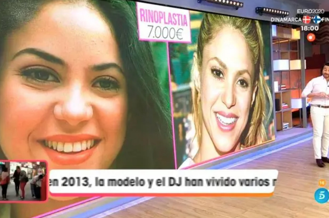 Shakira antes y después