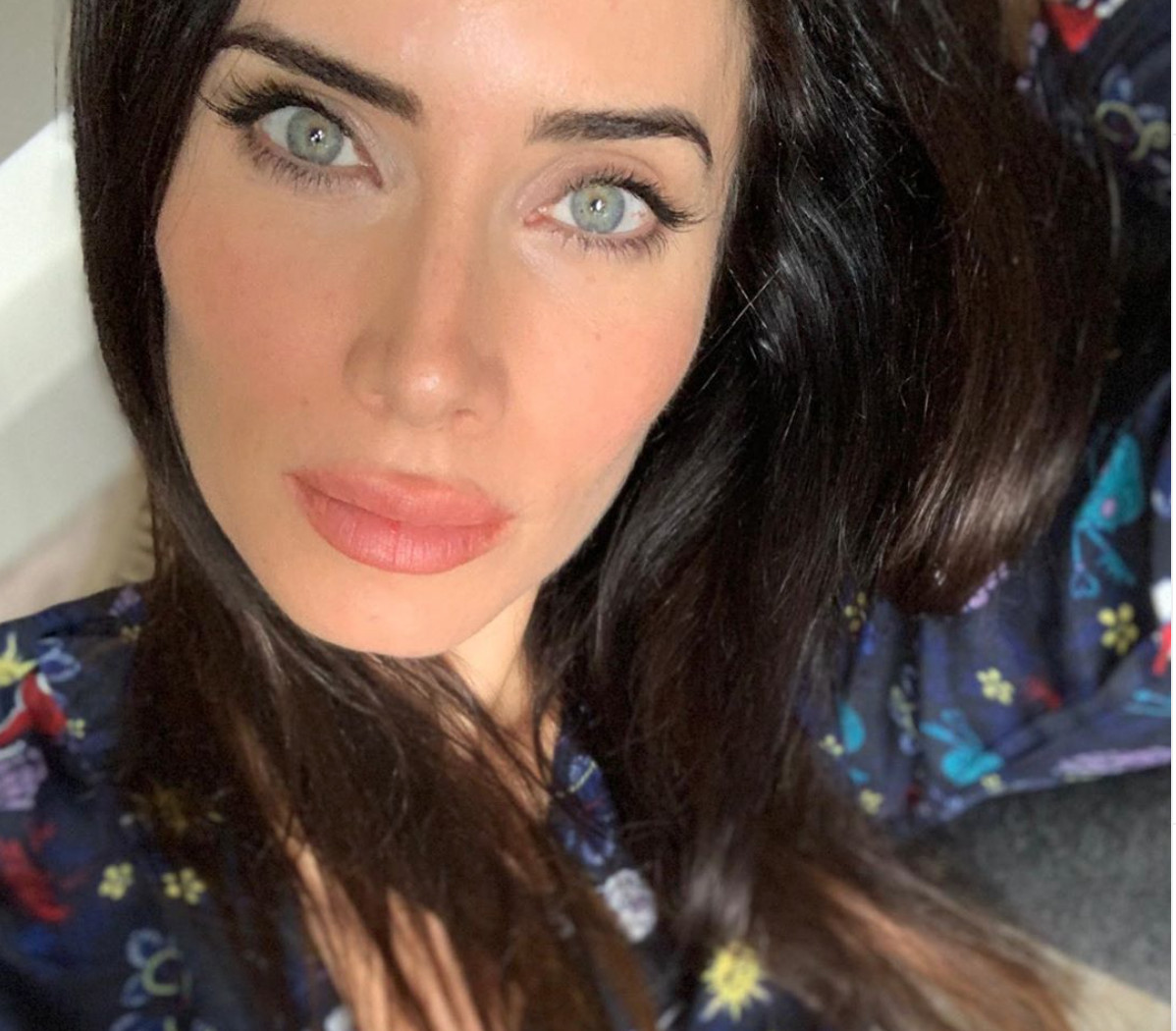 Pilar Rubio labios hinchados