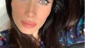 Pilar Rubio labios hinchados