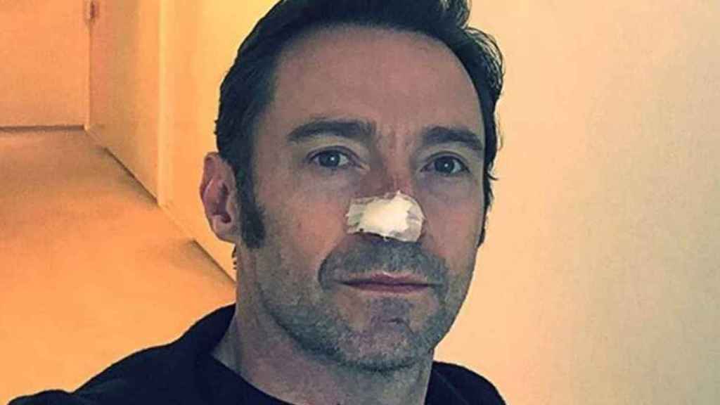 El actor Hugh Jackman, tras la operación en la que han extirpado el cáncer / INSTAGRAM