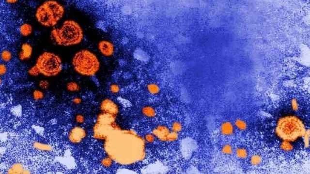 Imagen de la hepatitis en un microscopio / EP