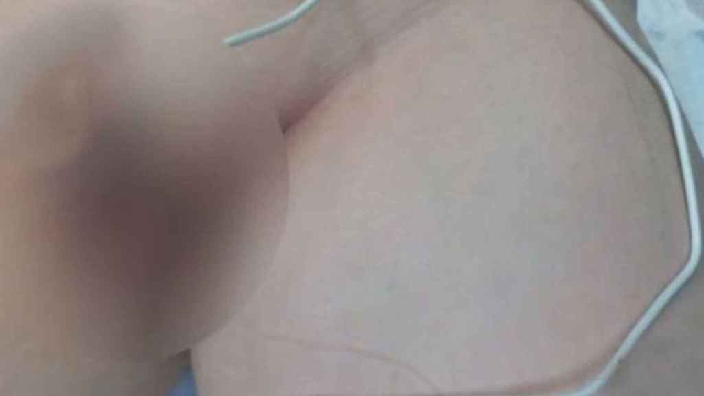 Imagen del niño que enchufó un cable USB en su pene