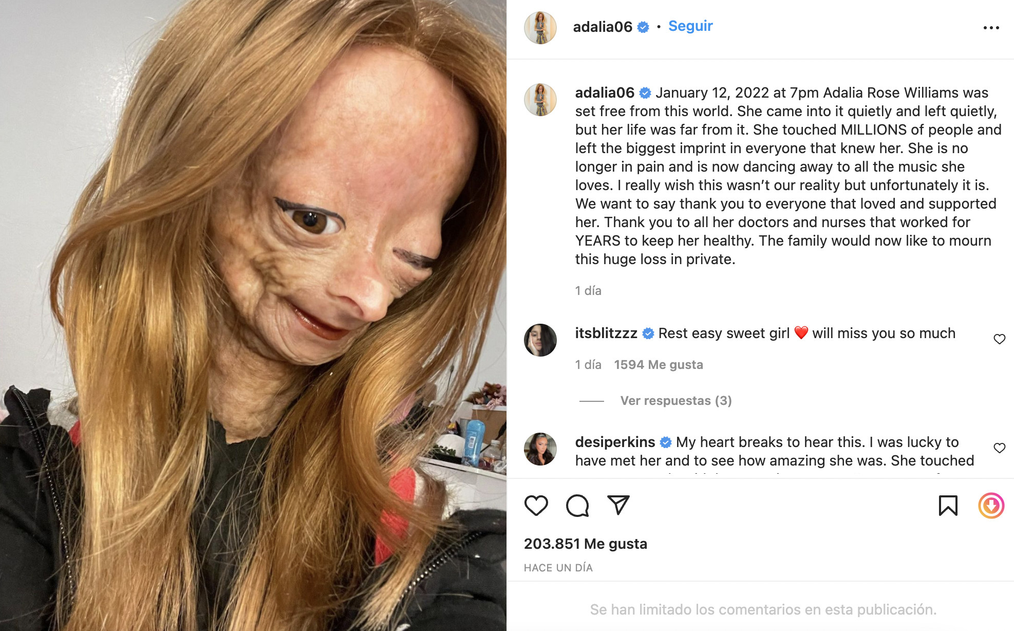 Publicación de Adalia Rose en Instagram / @adalia06