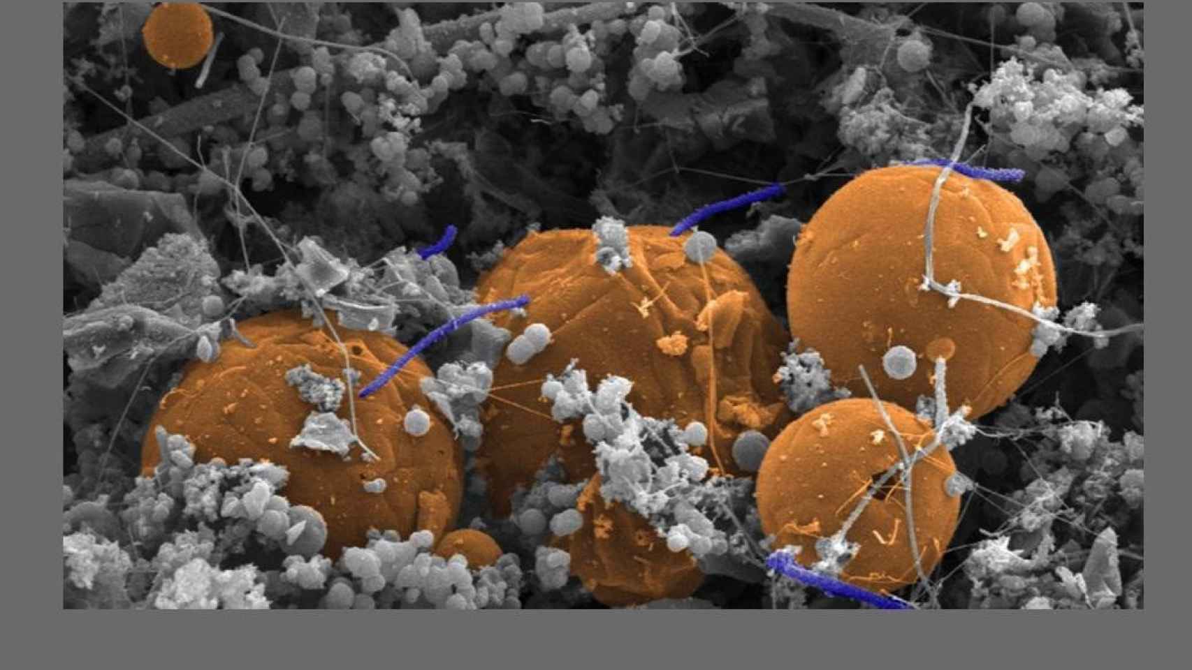 Bacterias que son capaces de sobrevivir al hidrógeno en el ecosistema hallado bajo la superficie terrestre / UNIVERSITY OF QUEENSLAND