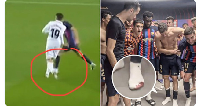 El pisotón de Ceballos a Lewandowski antes del empujón de Gavi / REDES