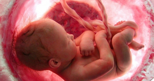 Imagen de un bebé en el utero cuando aún mantiene el cordón umbilical