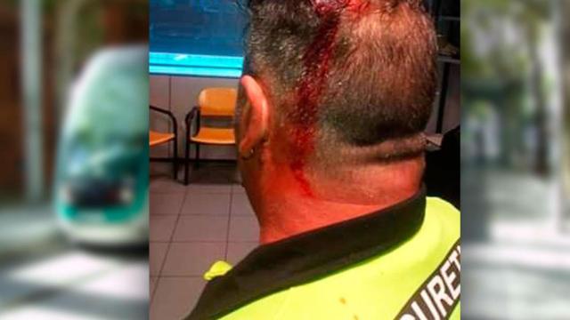 Heridas causadas al vigilantes de seguridad con el TRAMBesòs de fondo / CG