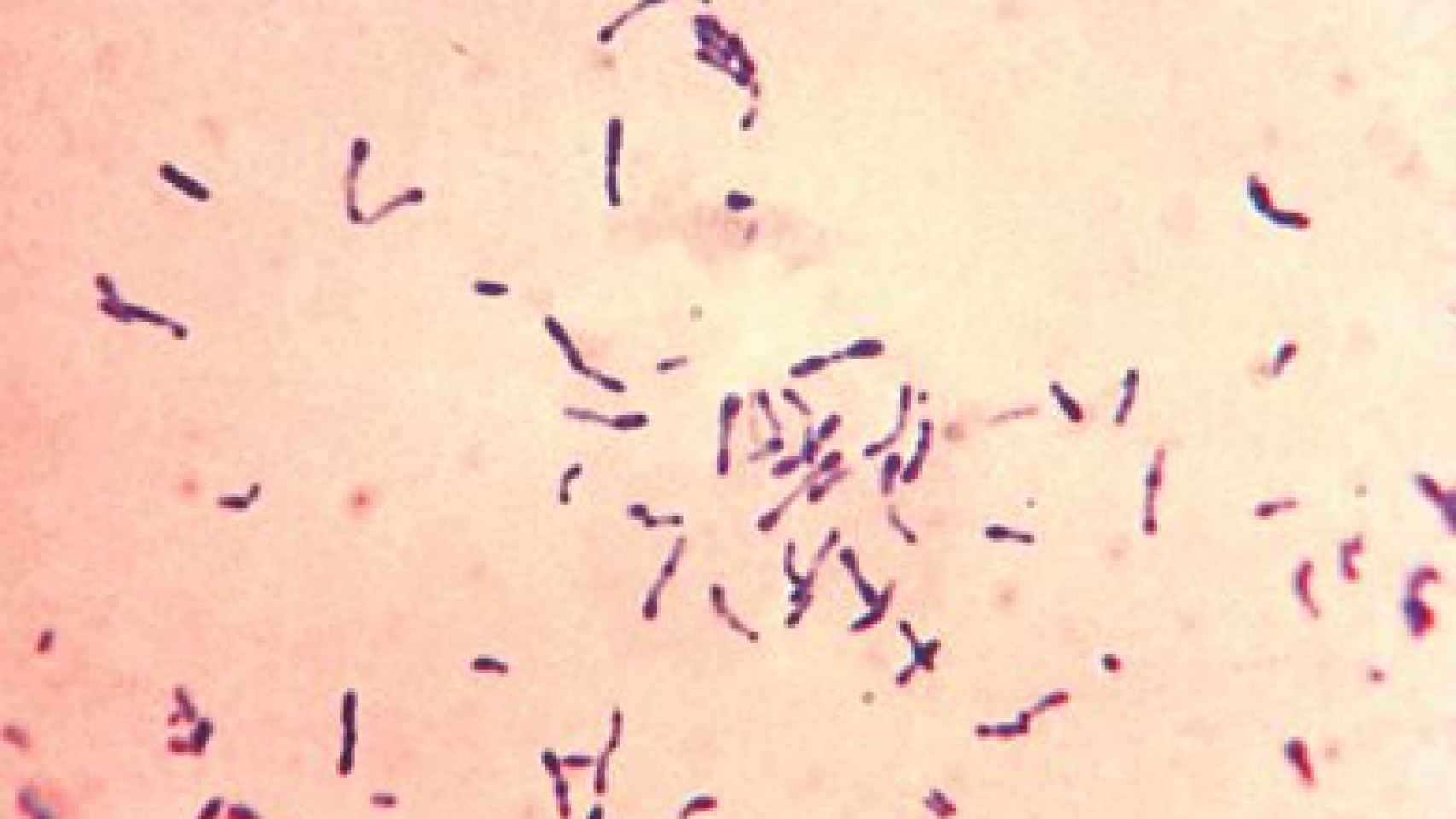 Corynebacterium diphtheriae