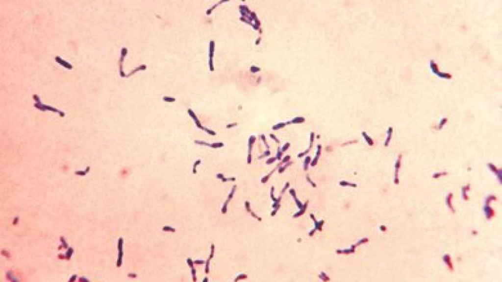 Corynebacterium diphtheriae