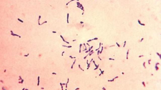 Corynebacterium diphtheriae