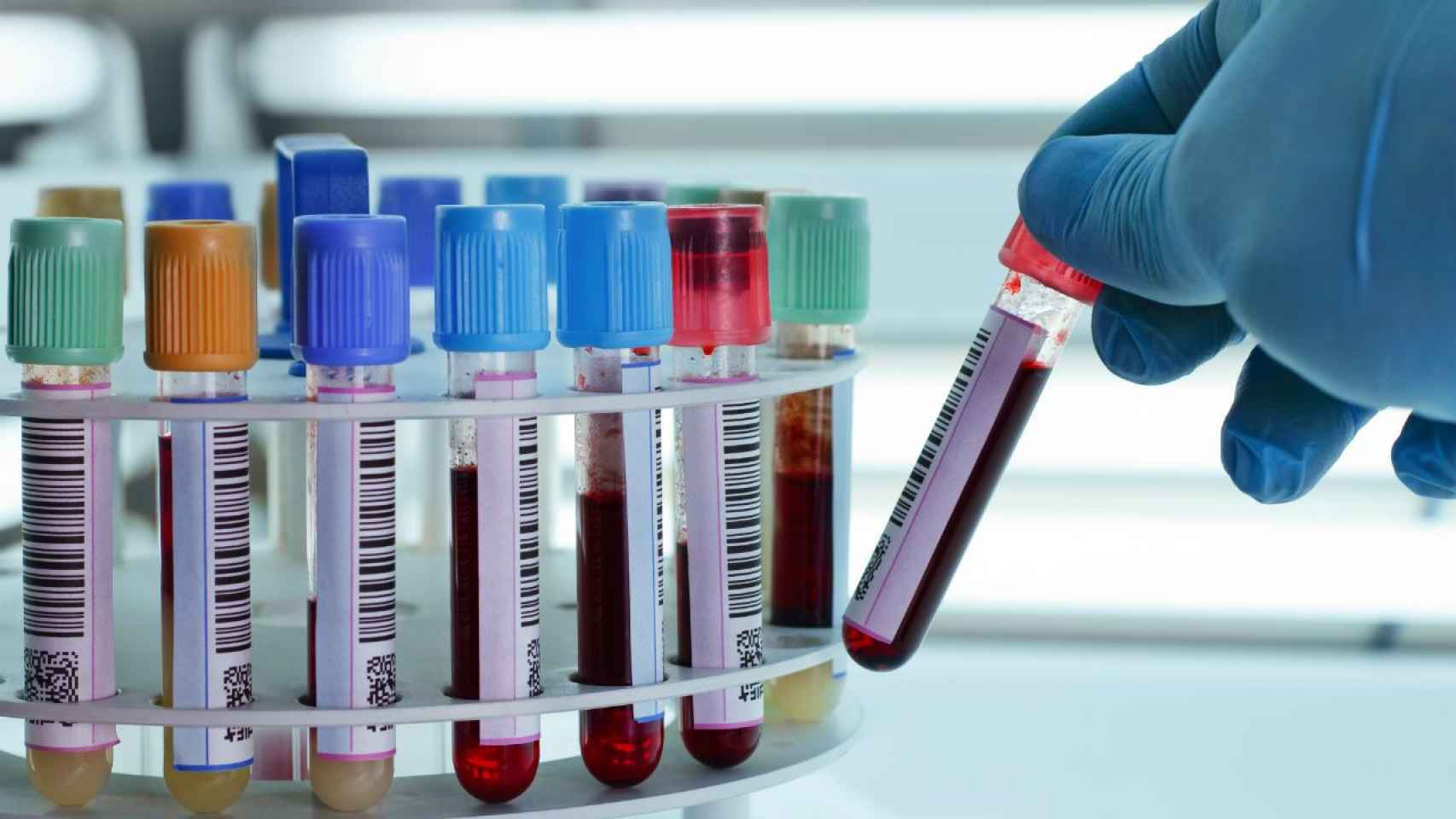 Muestras de sangre en un laboratorio