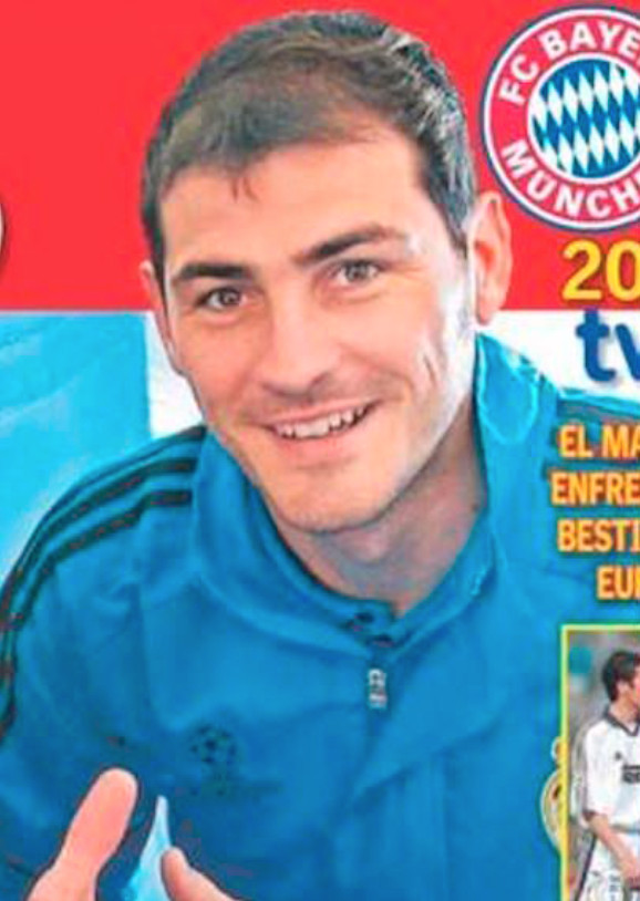 Iker Casillas alopecia