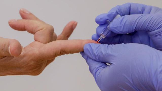 Un sanitario realiza la prueba del Covid-19 a un pacientes / RICARDO RUBIO-EUROPAPRESS