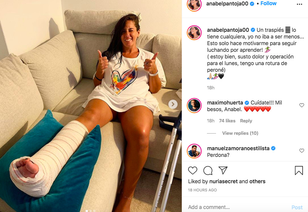 Anabel Pantoja se rompe el peroné aprendiendo a surfear en Canarias / INSTAGRAM