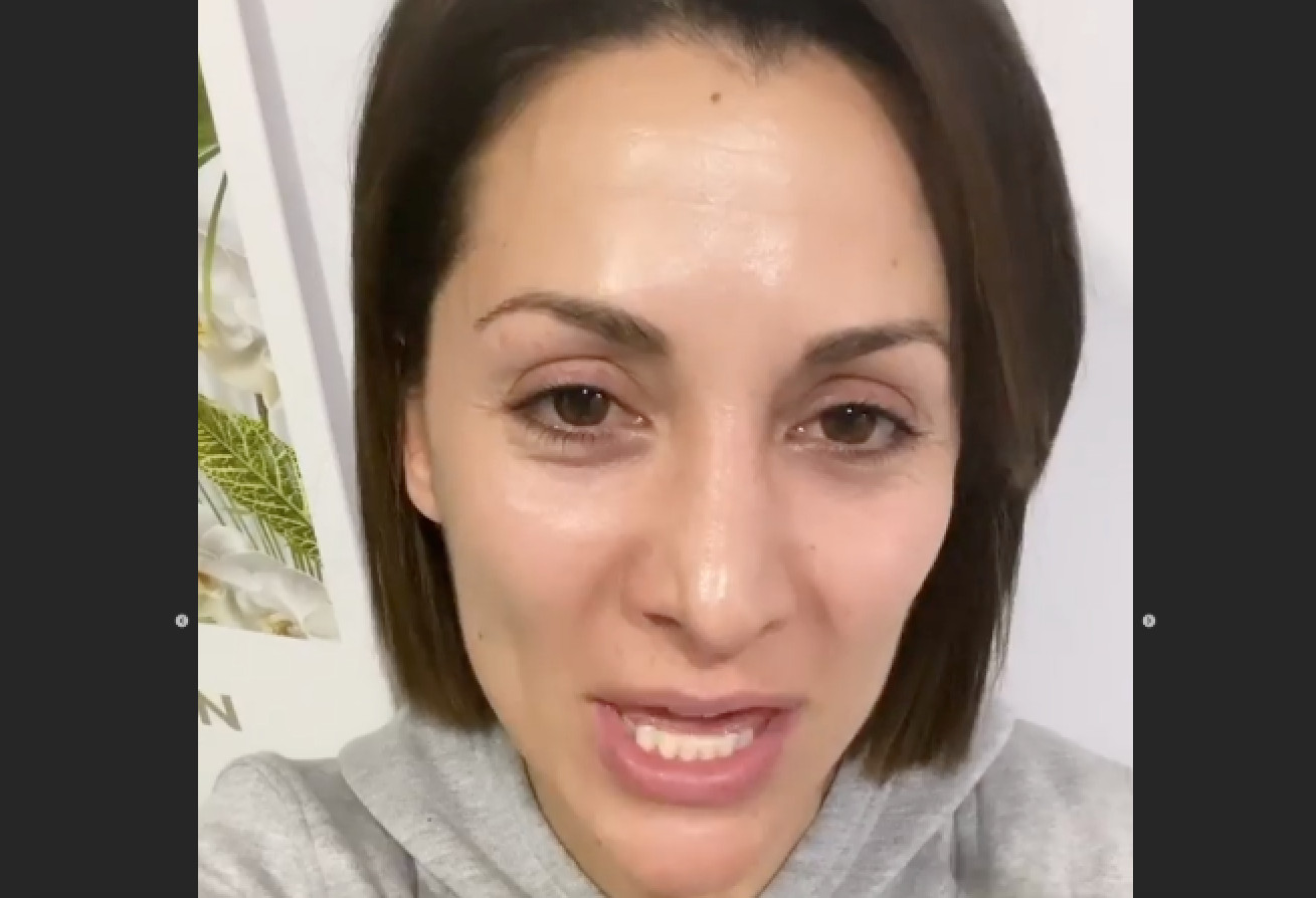 Nagore Robles enseña la cara que se le ha quedado después de su última intervención facial / INSTAGRAM