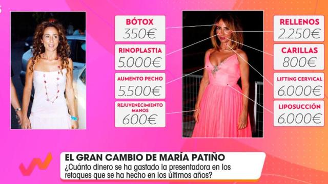 Los retoques de María Patiño /TELECINCO