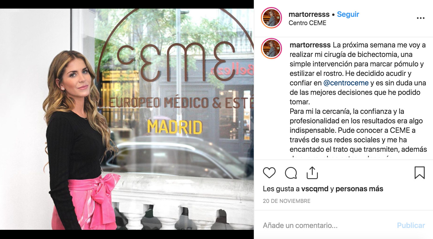 Mar Torres presume de cara operada en sus redes sociales / INSTAGRAM