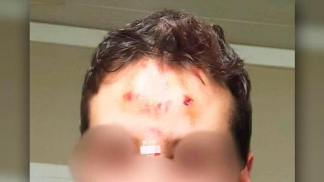 Imagen del vigilante de Cercanías apedreado en la estación de Sant Vicenç de Calders (Tarragona) / CG