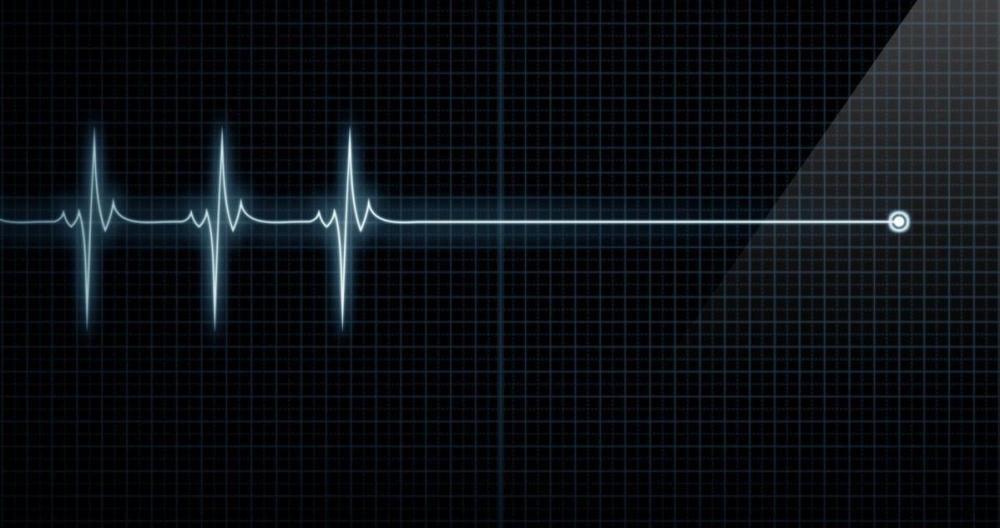 La línea de los latidos del corazón antes de morir / CG