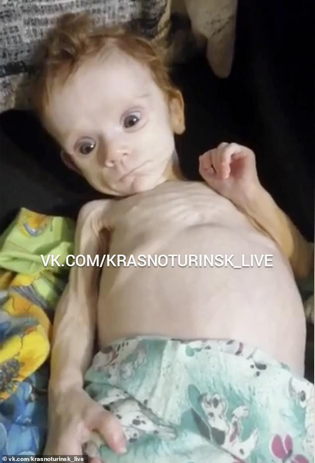 Bebé de una madre que lo dejó morir de hambre